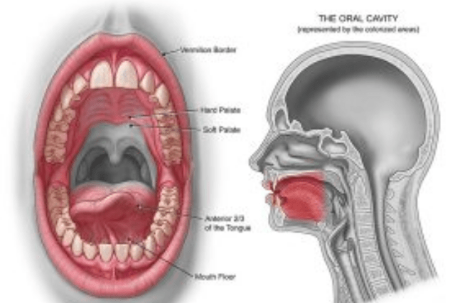 Oral Cancer Surgery