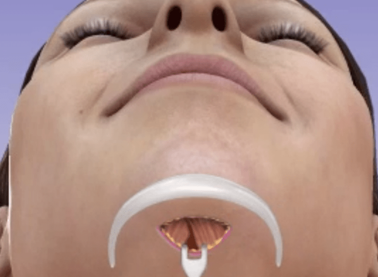 Best-Chin-Surgeon-in-Mumbai-dr-Tofiq-bohra-1-min