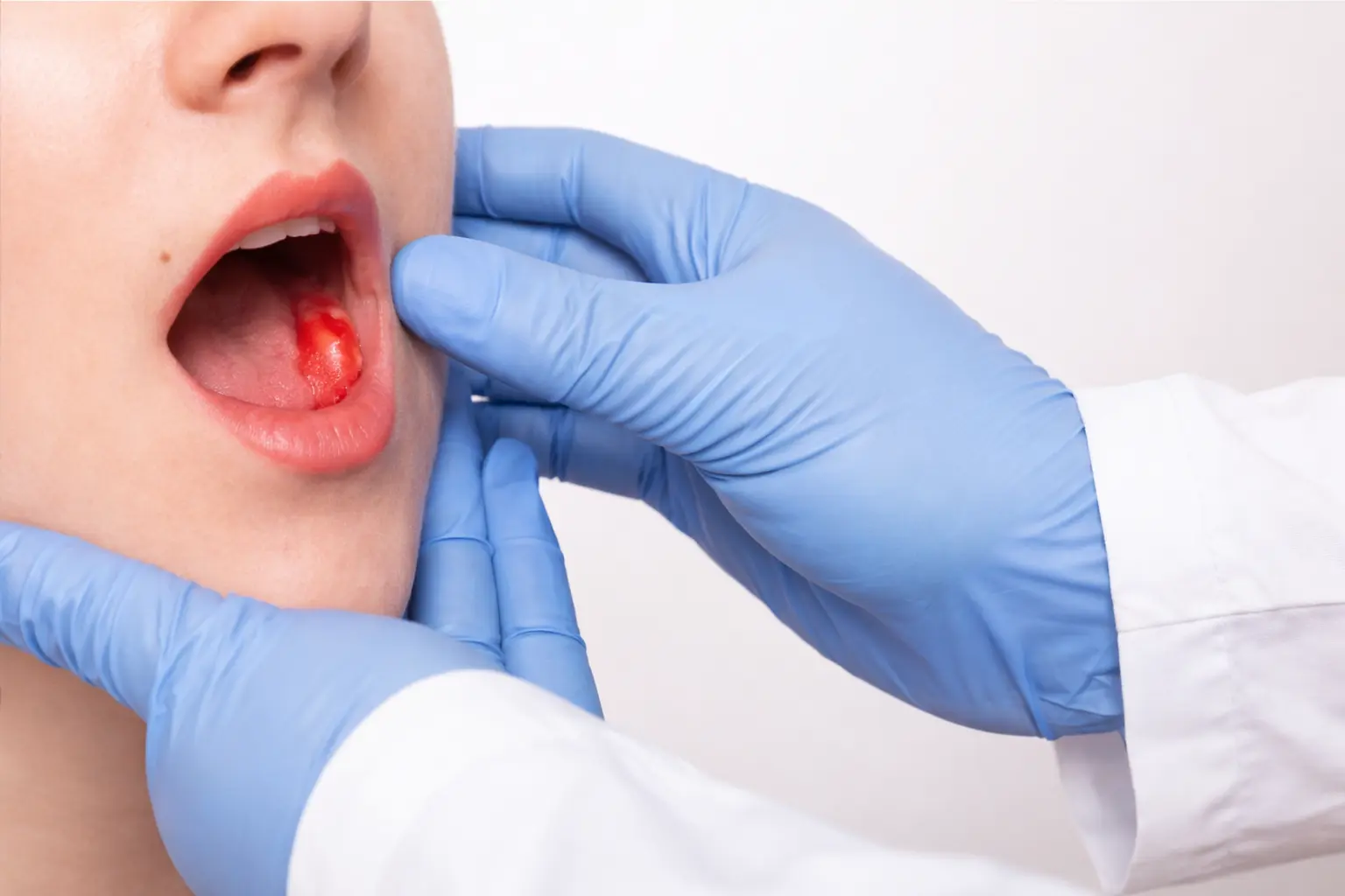 Oral Cancer Treatment in Mumbai